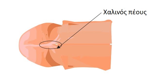 xalinos
